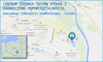 PRACOWNIA TOMOGRAFII KOMPUTEROWEJ - CENTRUM ZDROWIA TUCHÓW SPÓŁKA Z OGRANICZONĄ ODPOWIEDZIALNOŚCIĄ - UL. SZPITALNA 1, TUCHÓW